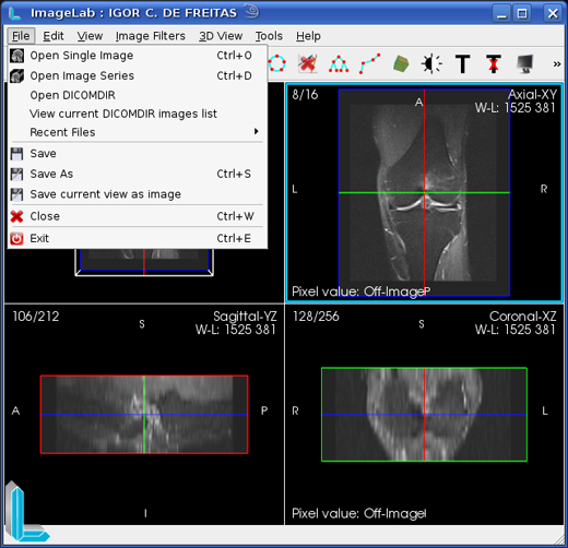 create dicomdir from dicom files extension